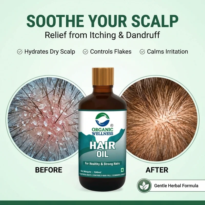 Organic Wellness Hair Oil – Bhringraj & Amla – Strong & Healthy Hair – 100 ml thumbnail